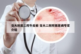 交大附属二院牛皮癣 交大二附院银屑病专家介绍