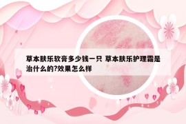 草本肤乐软膏多少钱一只 草本肤乐护理霜是治什么的?效果怎么样