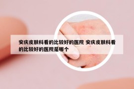 安庆皮肤科看的比较好的医院 安庆皮肤科看的比较好的医院是哪个