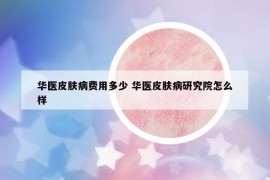 华医皮肤病费用多少 华医皮肤病研究院怎么样