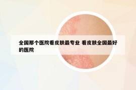 全国那个医院看皮肤最专业 看皮肤全国最好的医院