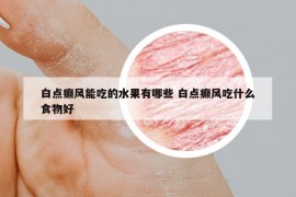 白点癫风能吃的水果有哪些 白点癫风吃什么食物好