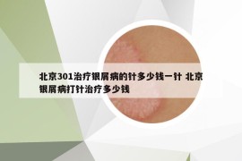 北京301治疗银屑病的针多少钱一针 北京银屑病打针治疗多少钱