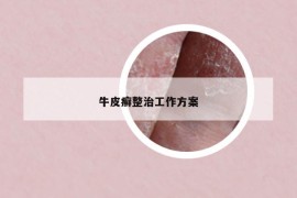 牛皮癣整治工作方案