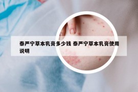 泰严宁草本乳膏多少钱 泰严宁草本乳膏使用说明