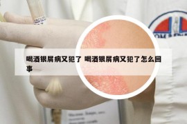 喝酒银屑病又犯了 喝酒银屑病又犯了怎么回事