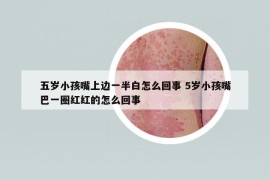 五岁小孩嘴上边一半白怎么回事 5岁小孩嘴巴一圈红红的怎么回事