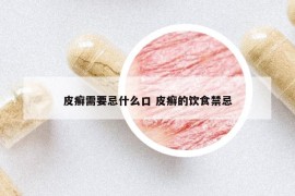 皮癣需要忌什么口 皮癣的饮食禁忌