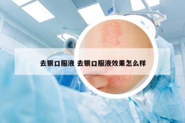 去银口服液 去银口服液效果怎么样