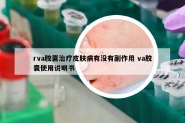 rva胶囊治疗皮肤病有没有副作用 va胶囊使用说明书