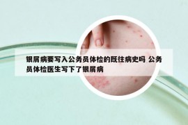 银屑病要写入公务员体检的既往病史吗 公务员体检医生写下了银屑病