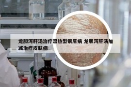 龙胆泻肝汤治疗湿热型银屑病 龙胆泻肝汤加减治疗皮肤病