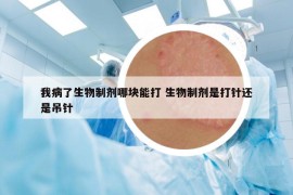 我病了生物制剂哪块能打 生物制剂是打针还是吊针