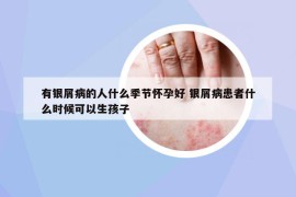 有银屑病的人什么季节怀孕好 银屑病患者什么时候可以生孩子