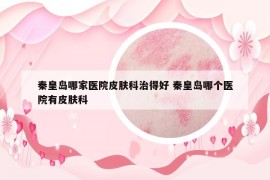 秦皇岛哪家医院皮肤科治得好 秦皇岛哪个医院有皮肤科