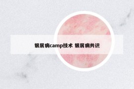 银屑病camp技术 银屑病共识