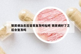 银屑病治愈后容易复发吗贴吧 银屑病好了之后会复发吗
