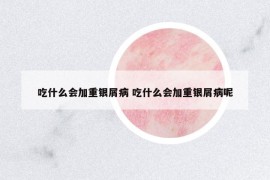 吃什么会加重银屑病 吃什么会加重银屑病呢