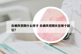 白癞风初期什么样子 白癞风初期长在哪个部位?