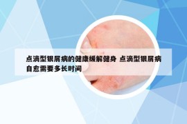 点滴型银屑病的健康缓解健身 点滴型银屑病自愈需要多长时间