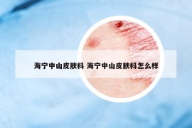 海宁中山皮肤科 海宁中山皮肤科怎么样