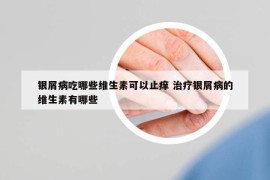 银屑病吃哪些维生素可以止痒 治疗银屑病的维生素有哪些