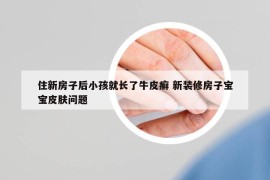 住新房子后小孩就长了牛皮癣 新装修房子宝宝皮肤问题
