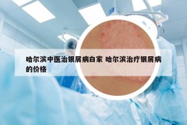 哈尔滨中医治银屑病白家 哈尔滨治疗银屑病的价格