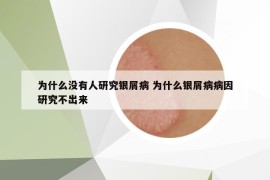 为什么没有人研究银屑病 为什么银屑病病因研究不出来