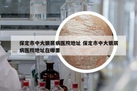 保定市中大银屑病医院地址 保定市中大银屑病医院地址在哪里