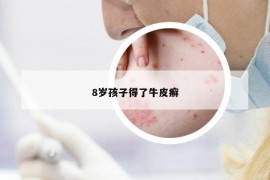 8岁孩子得了牛皮癣