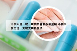 小孩头皮一块一块的白色会不会是癣 小孩头皮出现一大块大块白皮子