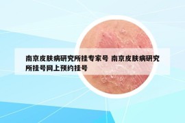 南京皮肤病研究所挂专家号 南京皮肤病研究所挂号网上预约挂号