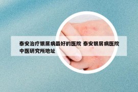 泰安治疗银屑病最好的医院 泰安银屑病医院中医研究所地址
