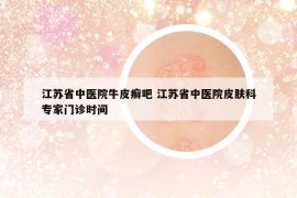 江苏省中医院牛皮癣吧 江苏省中医院皮肤科专家门诊时间