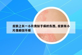 皮肤上长一小片类似于癣的东西, 皮肤有小片像癣但不痒