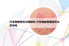 打生物制剂可以喂奶吗 打生物制剂期间可以怀孕吗