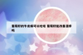 葡萄籽的牛皮癣可以吃哇 葡萄籽能改善湿疹吗