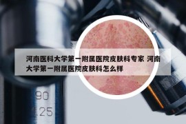 河南医科大学第一附属医院皮肤科专家 河南大学第一附属医院皮肤科怎么样