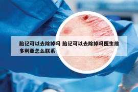 胎记可以去除掉吗 胎记可以去除掉吗医生维多利亚怎么联系