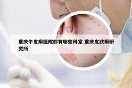重庆牛皮癣医院都有哪些科室 重庆皮肤癣研究所