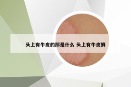 头上有牛皮的那是什么 头上有牛皮鲜