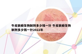 牛皮肤癣生物制剂多少钱一针 牛皮肤癣生物制剂多少钱一针2022年