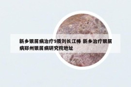 新乡银屑病治疗9质刘长江棒 新乡治疗银屑病郑州银屑病研究院地址