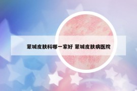 蒙城皮肤科哪一家好 蒙城皮肤病医院