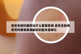 南京皮肤科医院治疗儿童银屑病 南京皮肤病研究所看银屑病最好的医生是哪位