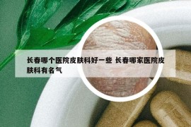 长春哪个医院皮肤科好一些 长春哪家医院皮肤科有名气