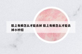 脸上有癣怎么才能去掉 脸上有癣怎么才能去掉小妙招