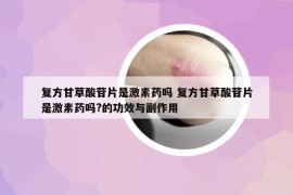 复方甘草酸苷片是激素药吗 复方甘草酸苷片是激素药吗?的功效与副作用
