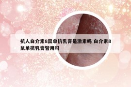 抗人白介素8鼠单抗乳膏是激素吗 白介素8鼠单抗乳膏管用吗